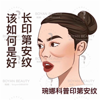 印第安纹剥离