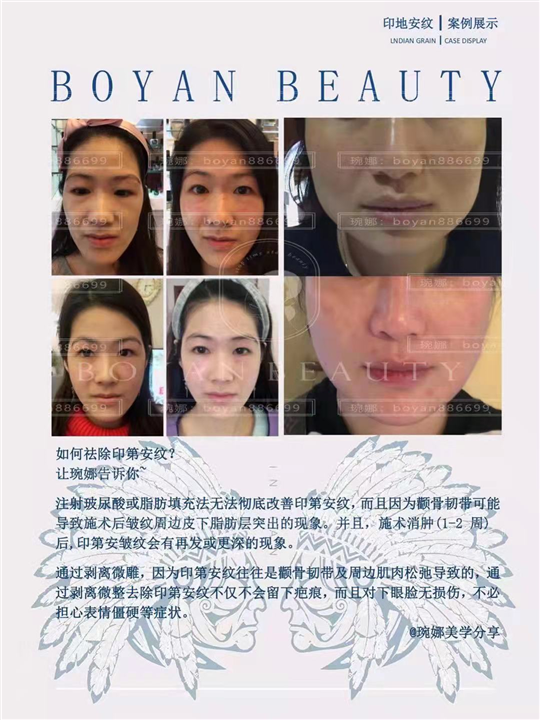 印第安纹