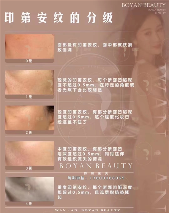 印第安纹等级自测