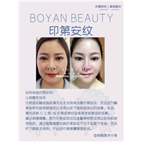 博妍剥离微雕