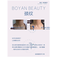 剥离颈纹