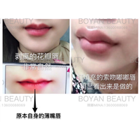 剥离花瓣唇