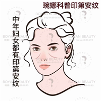 印第安纹剥离