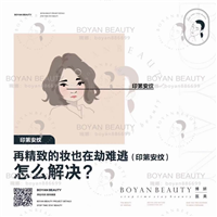 印第安纹剥离