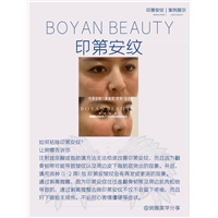 博妍剥离微雕
