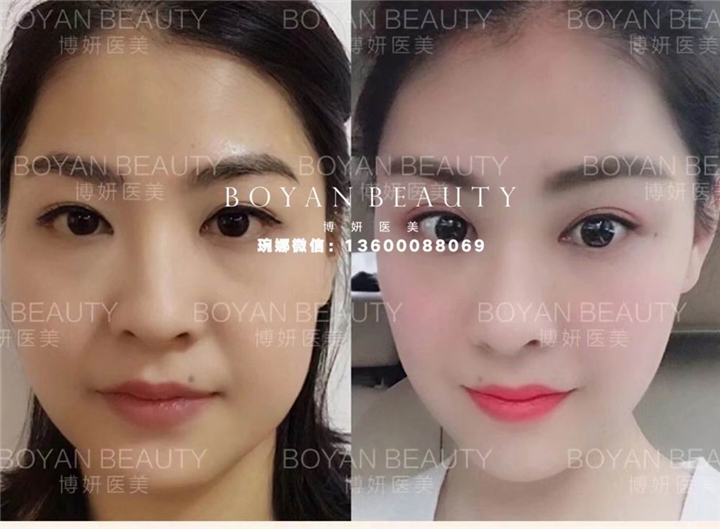 普宁博妍医美