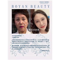 印第安纹如何祛除