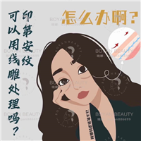 印第安纹剥离