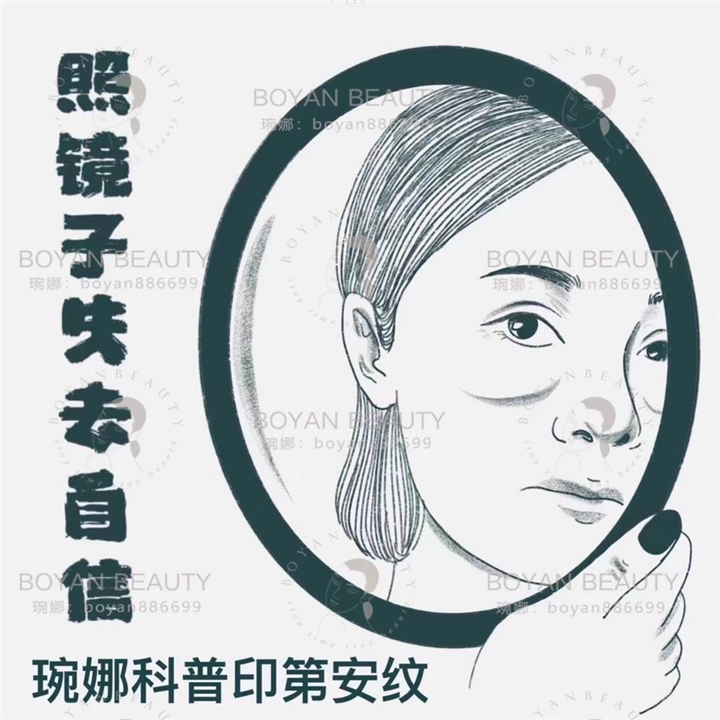 印第安纹剥离