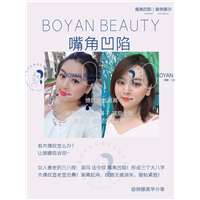 嘴角凹陷