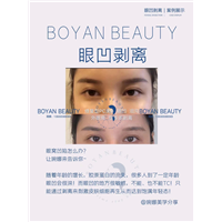 眼凹剥离