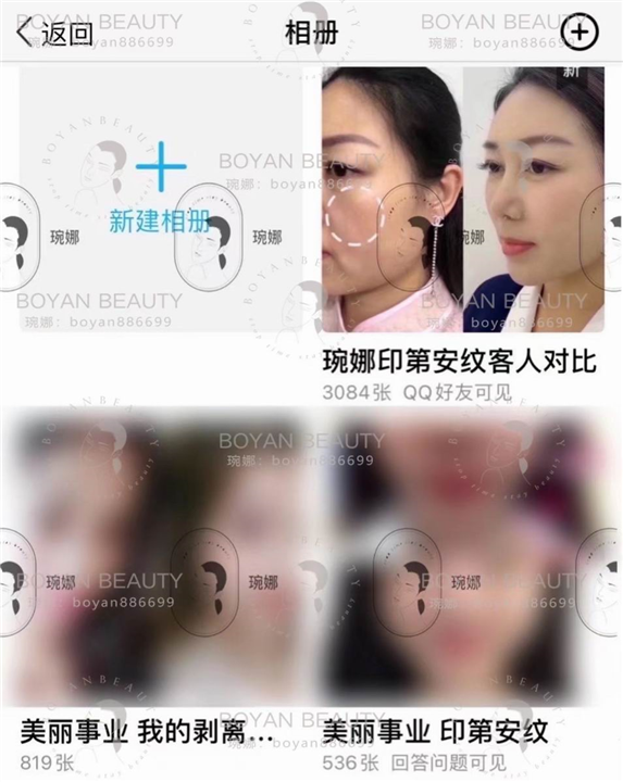 博妍剥离微整