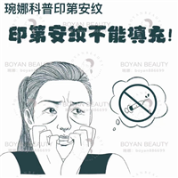印第安纹剥离