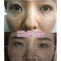 普宁博妍医美