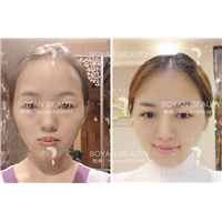 普宁博妍医美