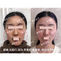 普宁博妍医美