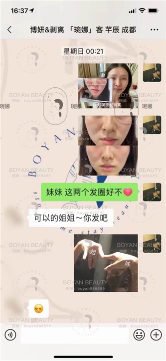 博妍剥离微整
