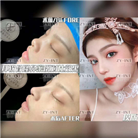 广州雅妍耳软骨鼻综合 