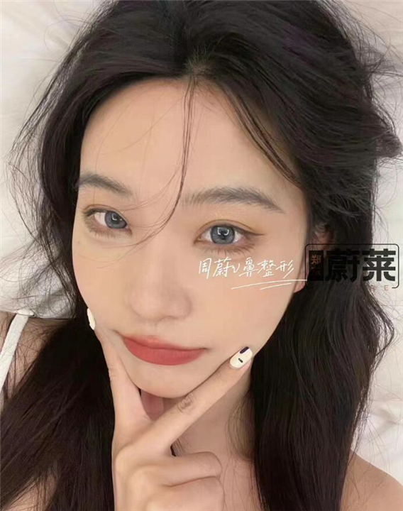 郑州鼻整形医生