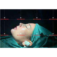 Doctor Yan plastic surgery