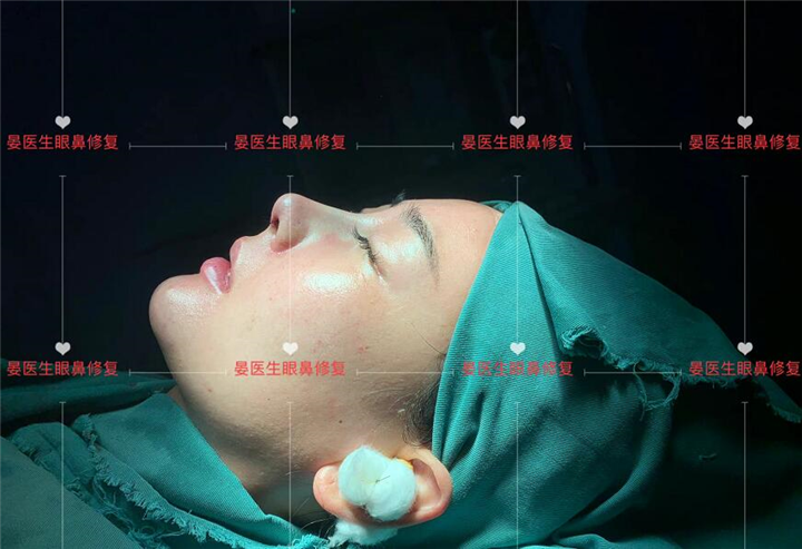 Doctor Yan plastic surgery