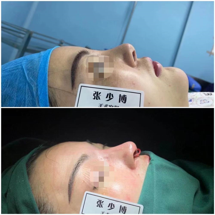 张少博