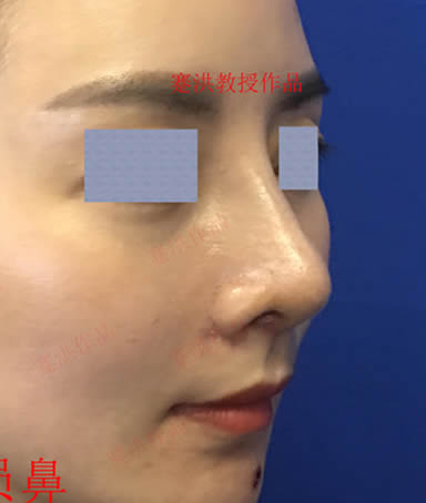 蹇洪