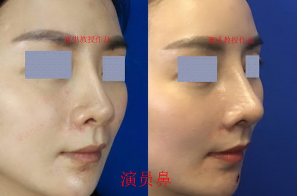 蹇洪