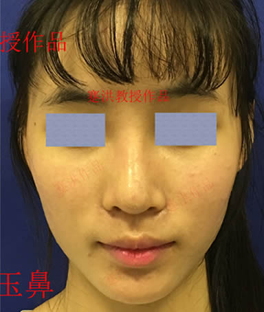 蹇洪