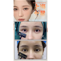 上海闫娇君医生灵动少女卧蚕打