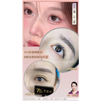 上海七星艺容术闫娇君医生双眼皮整形