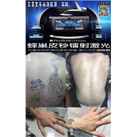 高邮纹身