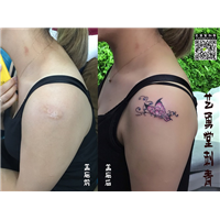 高邮遮盖纹身