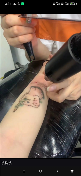 柯桥纹身疤痕遮盖多少钱一个