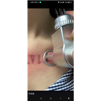 绍兴柯桥纹身店多少钱一个字