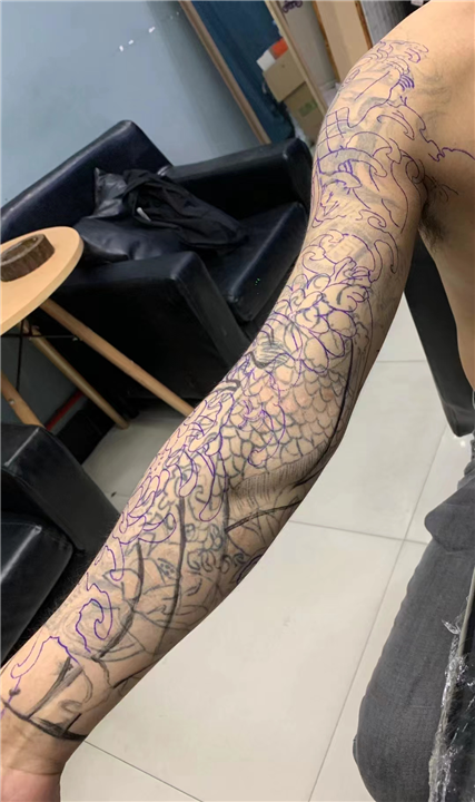 绍兴柯桥修改疤痕纹身皮秒价格多少