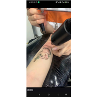 柯桥纹身疤痕遮盖多少钱一个