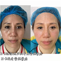 nk轻医美