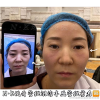 NK轻医美加盟