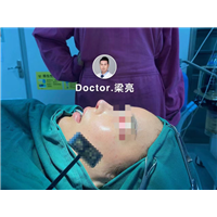 梁亮整形医生鼻整形案例