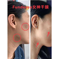fundesee面膜抗衰紧致