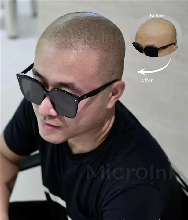 湖南SMP纹发
