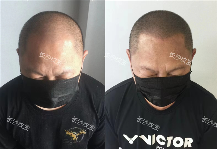 湖南纹发机构