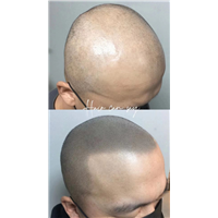 长沙SMP纹发