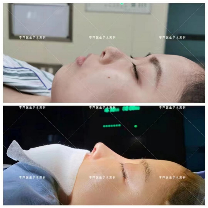 李萍医生