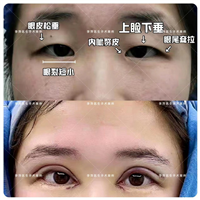 成都李萍整形医生