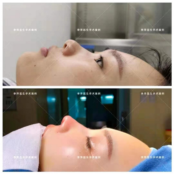 李萍医生