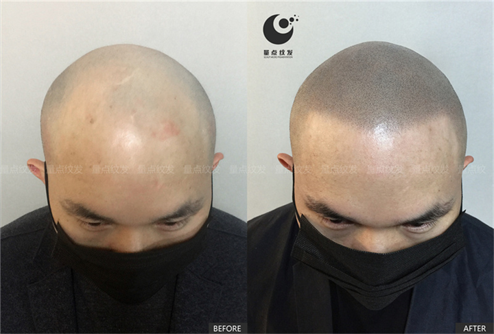 北京量点纹发怎么样？
