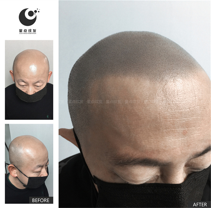 北京纹发怎么样