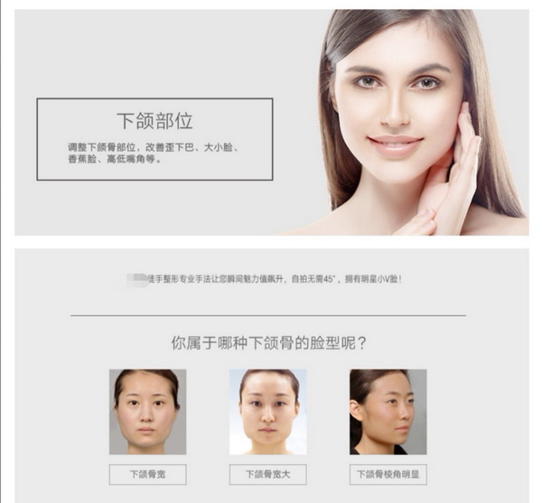 徒手整形张富源|广州徒手整形
